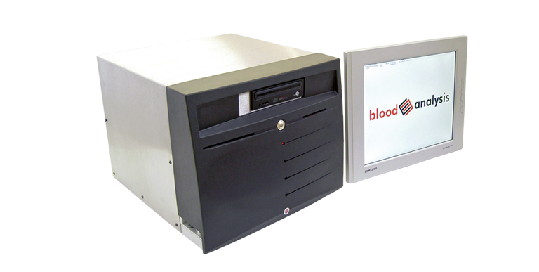 IDC creates Bio-sensing Technology blood analysis system